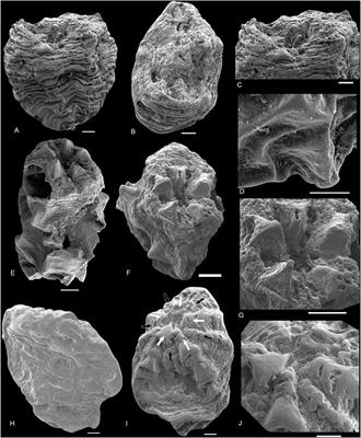 New Qinscyphus material from the Fortunian of South China